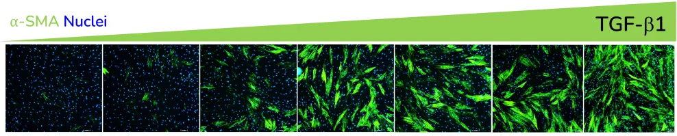 α-SMA expression in response to dose dependent treatment with TGF-β1. Images were acquired using the ImageXpress Confocal HT.ai imaging system.