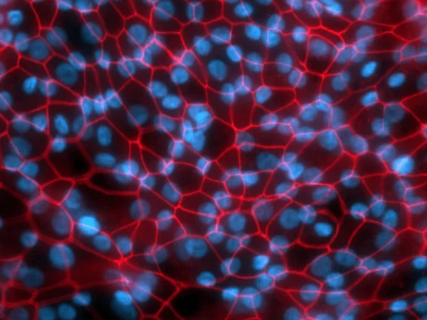 Small Airway Epithelial Cells immunostained to detect junctional protein ZO1, a marker for tight junctions