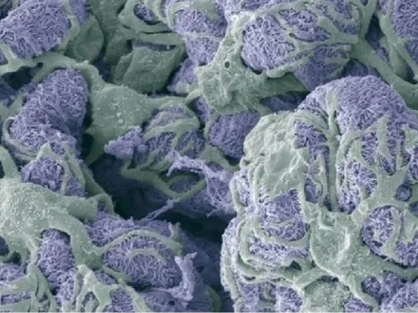 Kidney toxicity service: Investigative kidney toxicity and drug safety evaluation