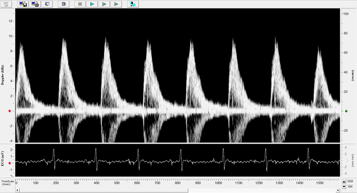 Rat - Transverse Aorta