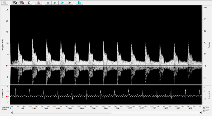 Mouse - Left Carotid