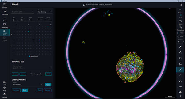 ImageXpress HCS.ai high-content screening