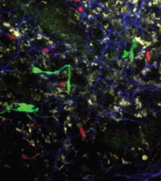 Dual wavelength imaging in lymph node explant