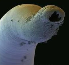 Clinical trials to test the safety of a first-of-its-kind human hookworm vaccine will begin in the Washington, DC area in a couple of months after the U.S. Food and Drug Administration conferred investigational new drug status on the vaccine.