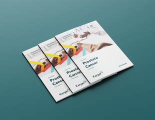 What to know about prostate cancer