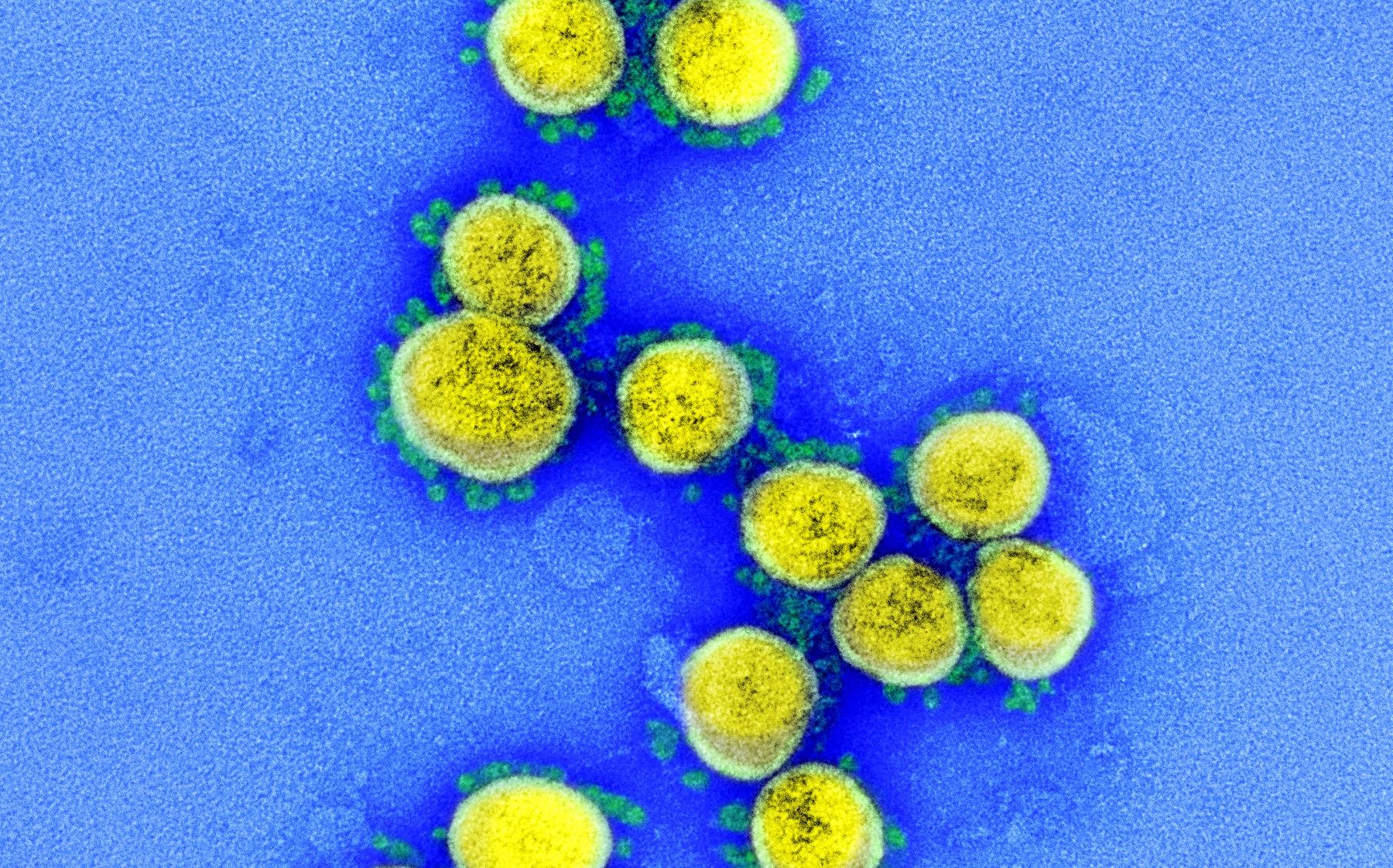 Study: The Delta variant of SARS-CoV-2 maintains high sensitivity to interferons in human lung cells. Image Credit: NIAID