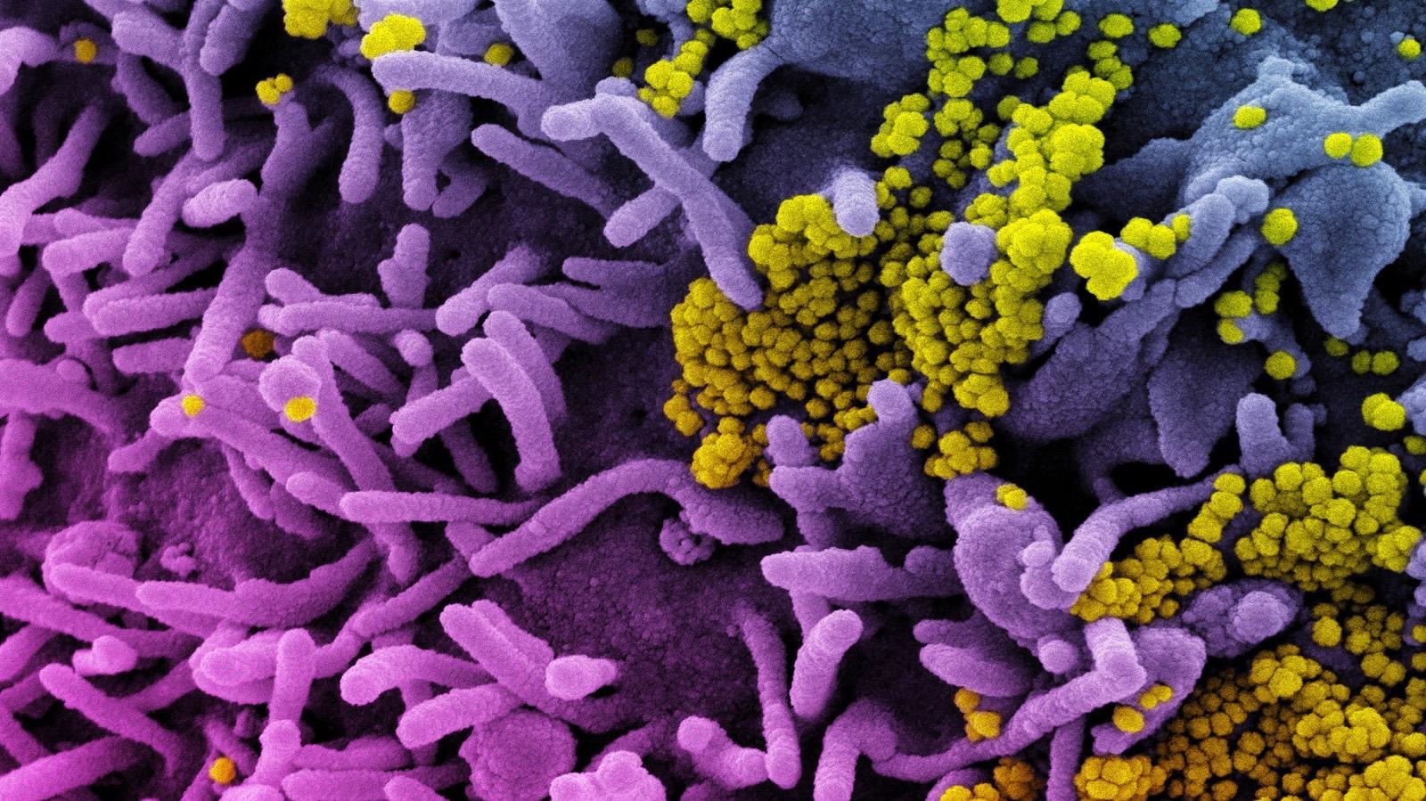 Study: Longitudinal analysis of antibody trajectories and humoral responses to a third dose of mRNA vaccines against SARS-CoV-2 in patients with a history of anti-CD20 therapy (RituxiVac 2.0). Image Credit: NIAID