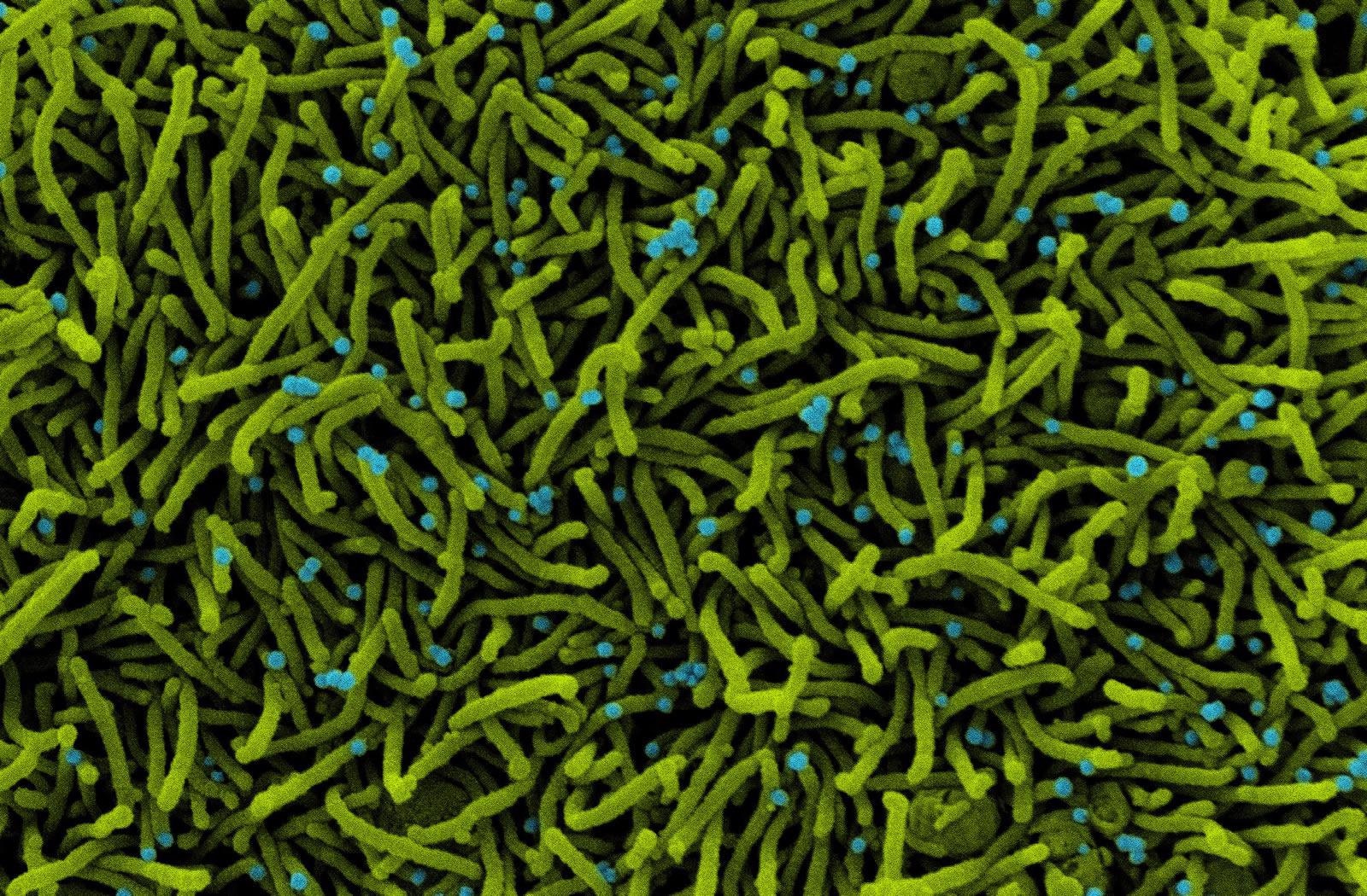 Study: The T cell receptor repertoire reflects the dynamics of the immune response to vaccination. Image Credit: NIAID