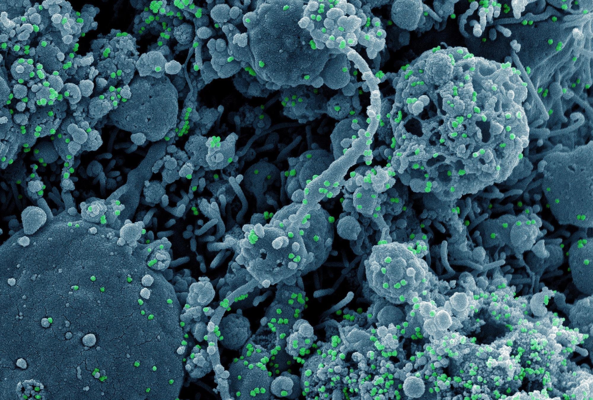 Neutralization of SARS-CoV-2 Omicron pseudovirus by BNT162b2 vaccine-elicited human sera. Image Credit: NIAID