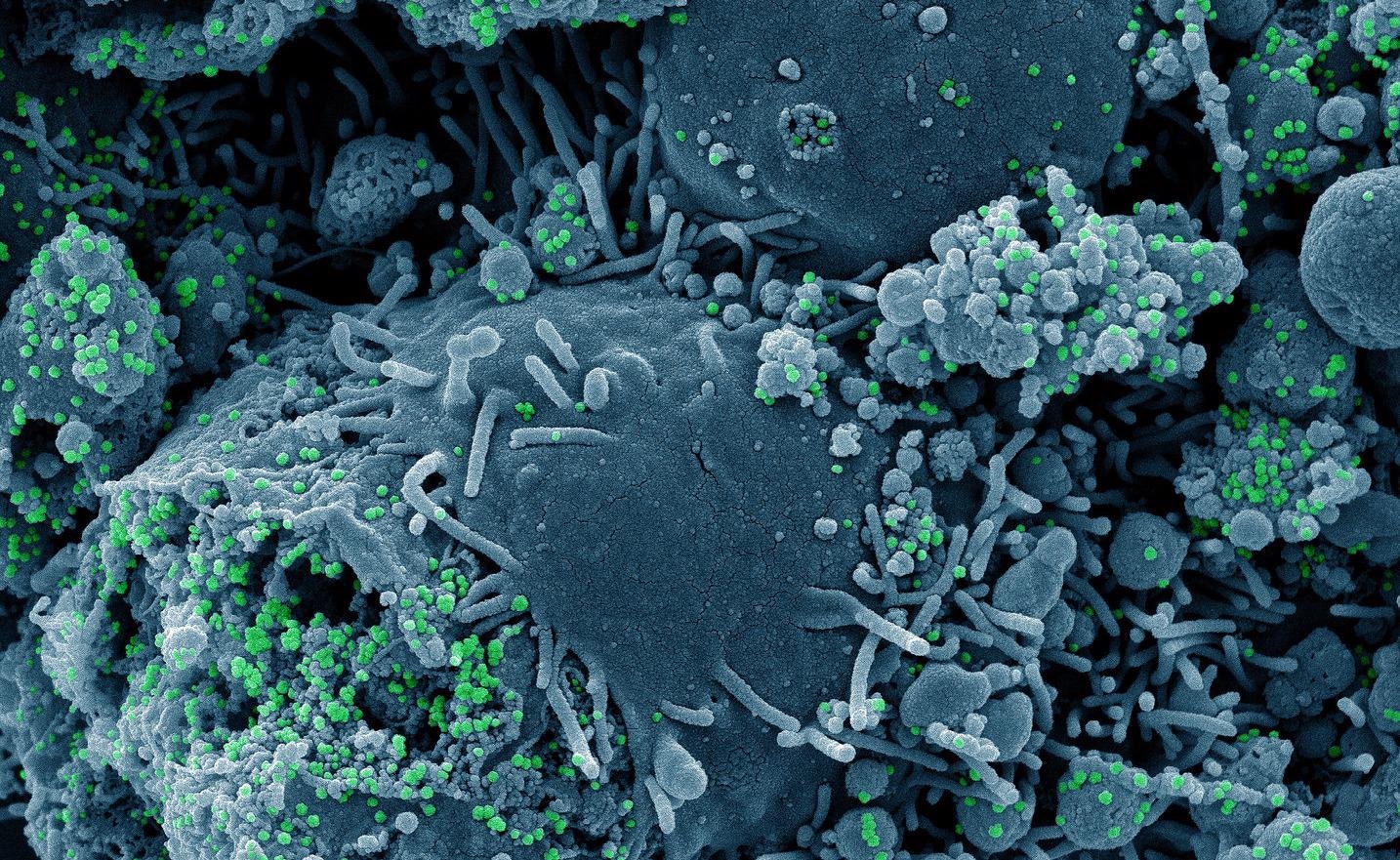 Study: Can individuals with low antibody responses to vaccines against other viruses acquire adequate SARS-CoV-2 antibody after vaccination with the BNT162b2 mRNA vaccine? Image Credit: NIAID