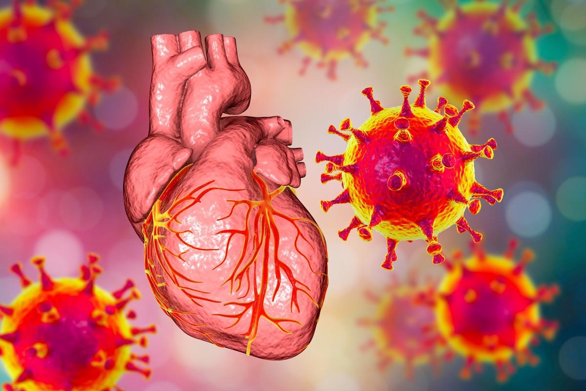Study: Inflammatory activation and immune cell infiltration are main biological characteristics of SARS-CoV-2 infected myocardium. Image Credit: Kateryna Kon/Shutterstock