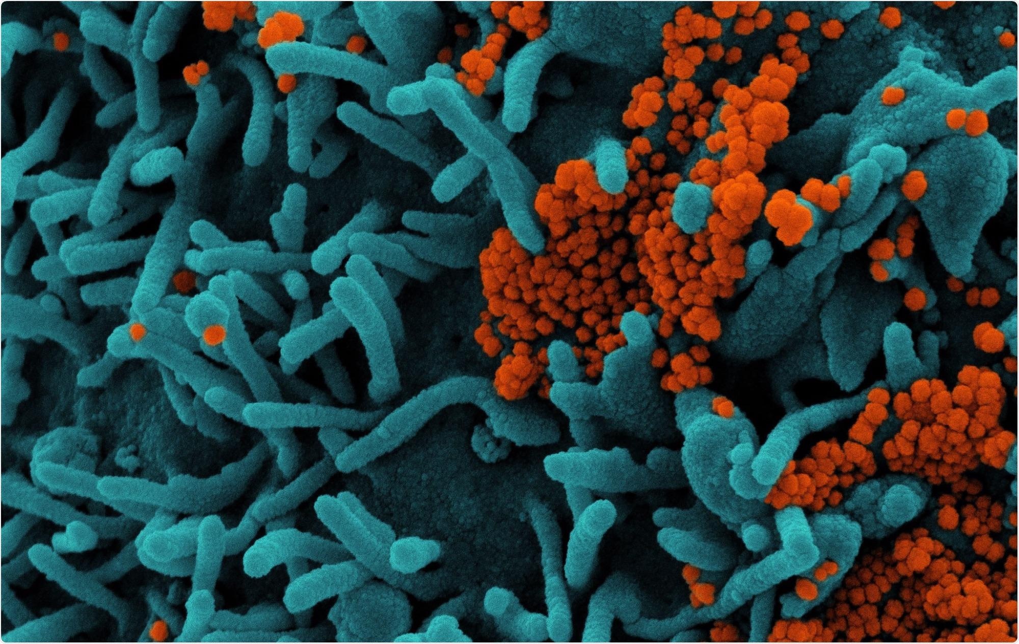 Study: Reduced Risk of Hospitalisation Associated With Infection With SARS-CoV-2 Omicron Relative to Delta: A Danish Cohort Study. Image Credit: NIAID