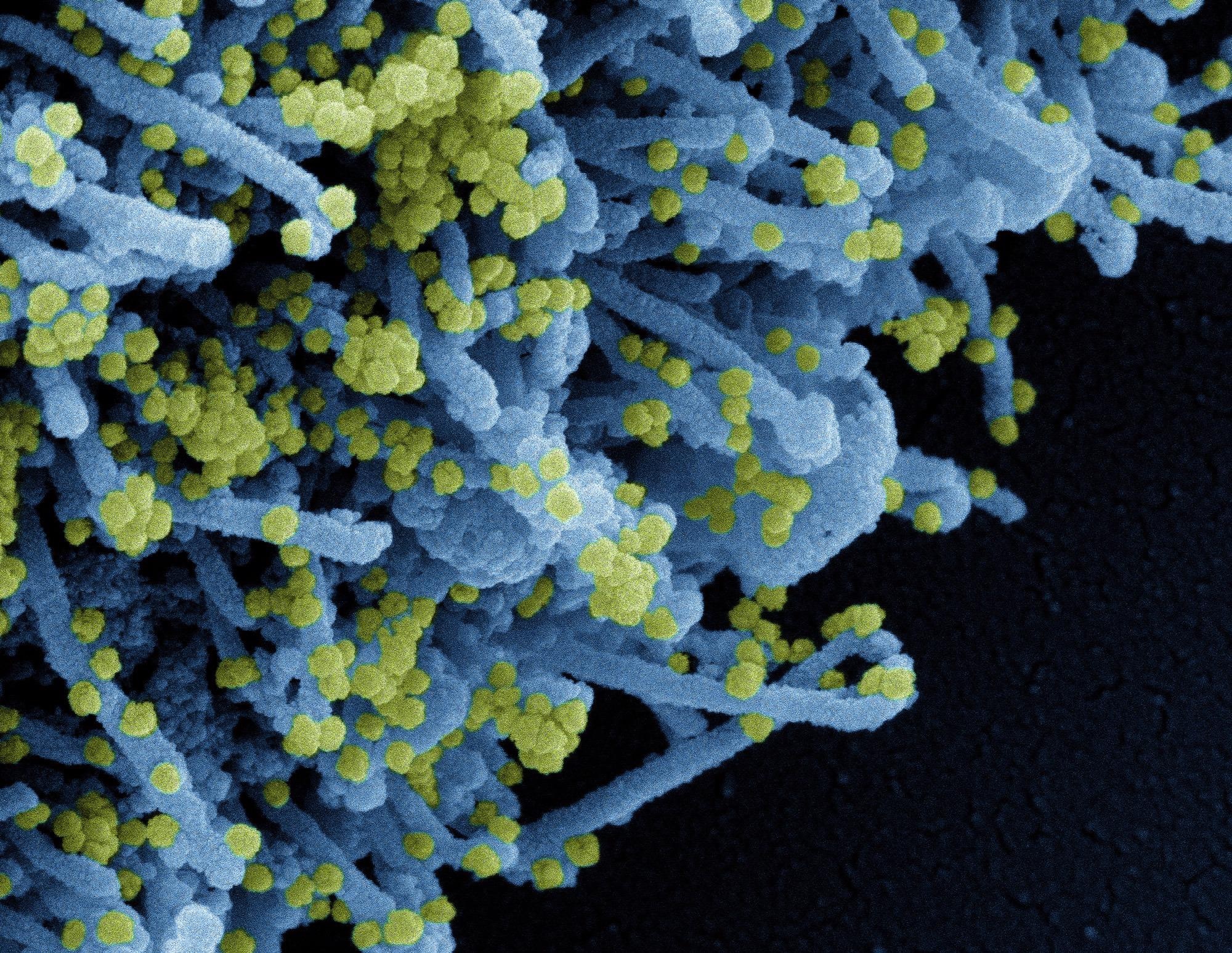 Study: Immune response to third SARS-CoV-2 vaccination in seronegative kidney transplant recipients: possible improvement by mycophenolate mofetil reduction. Image Credit: NIAID