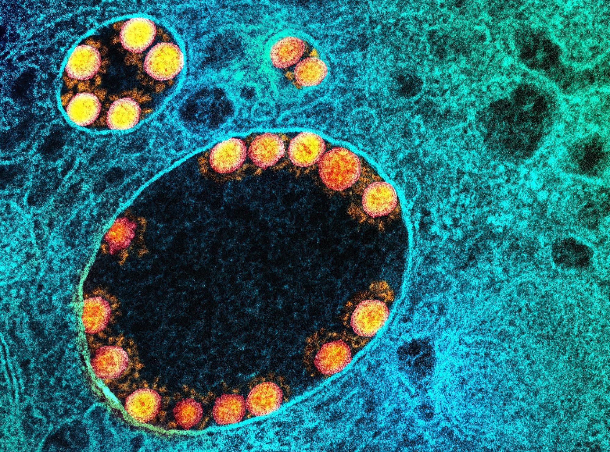Study: The oral drug nitazoxanide restricts SARS-CoV-2 infection and attenuates disease pathogenesis in Syrian hamsters. Image Credit: NIAID