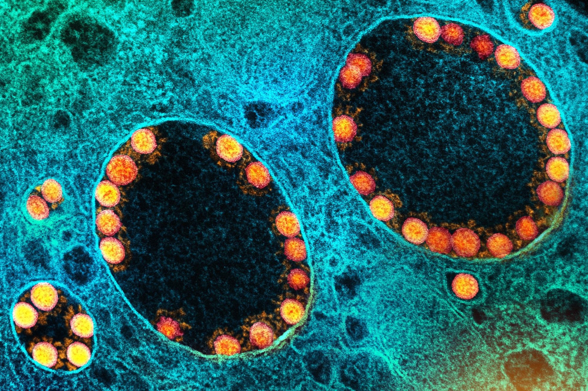 Study: Numb-associated kinases are required for SARS-CoV-2 infection and are cellular targets for therapy. Image Credit: NIAID