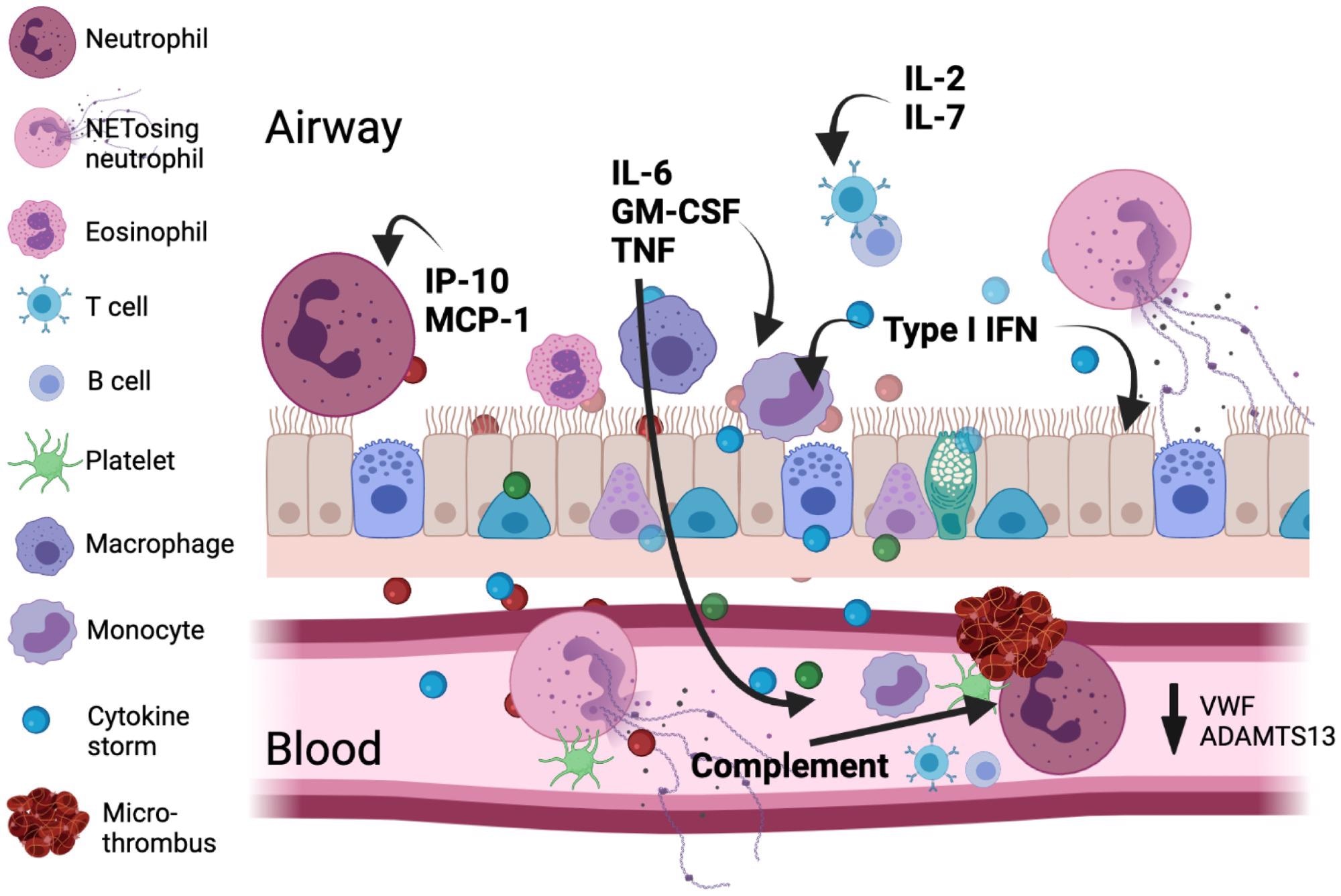 Major immunologic and coagulatory factors are implicated in COVID-19 pathology. The viral infection leads to type I IFN, inflammatory mediator, and alarmin release from the respiratory epithelium/endothelium and resident immune cells setting up a chemotactic gradient pulling cells from the circulation into the lung. An emergency myelopoietic state occurs and neutrophils and monocytes display abnormalities in the blood in this state of high inflammation. Lymphocytes concurrently become depleted in circulation. Activated monocytes and macrophages can be an important source of cytokines, including IL-6. Enhanced by complement, clusters of neutrophils and activated platelets occur and neutrophil NETosis in blood and tissue directly augments thrombosis by supporting platelet activation. The size for each cell indicates its relative abundance in each compartment.