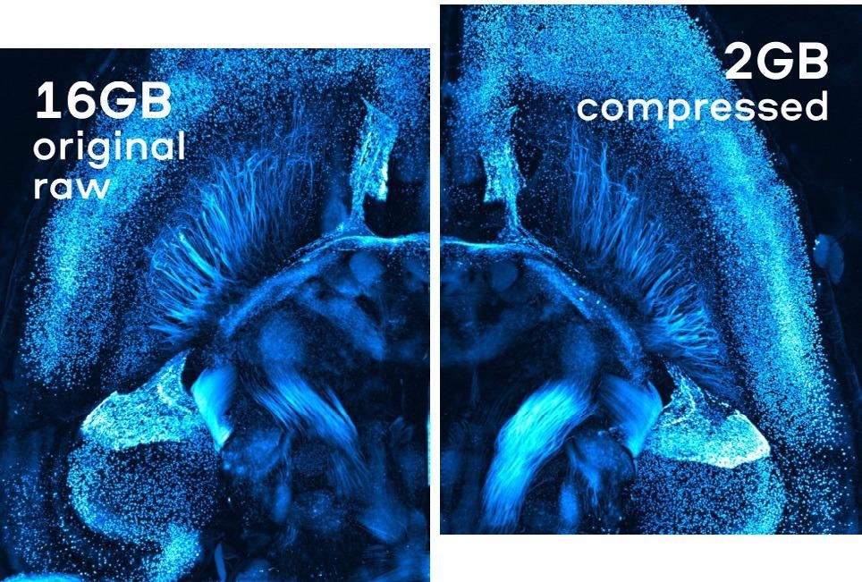 Research sample by Wyss Center for Bio and Neuroengineering. Acquired on Hamamatsu ORCA-Flash 4.0 and compressed with Jetraw.
