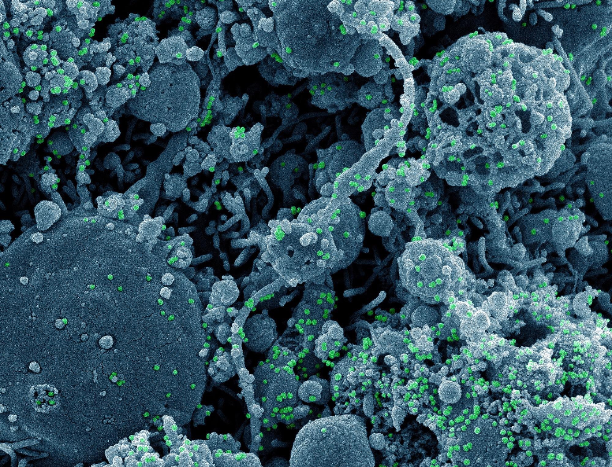 Study: CNBP restricts SARS-CoV2 by regulating IFN and disrupting RNA-protein condensates. Image Credit: NIAID