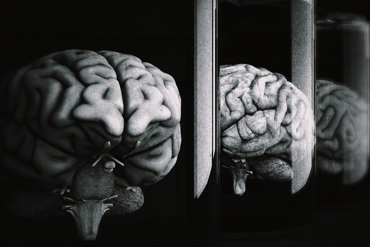 Study: Reactive and acute inflammatory microvasculopathy in 36 COVID-19 autopsy brains. Image Credit: boscorelli/Shutterstock