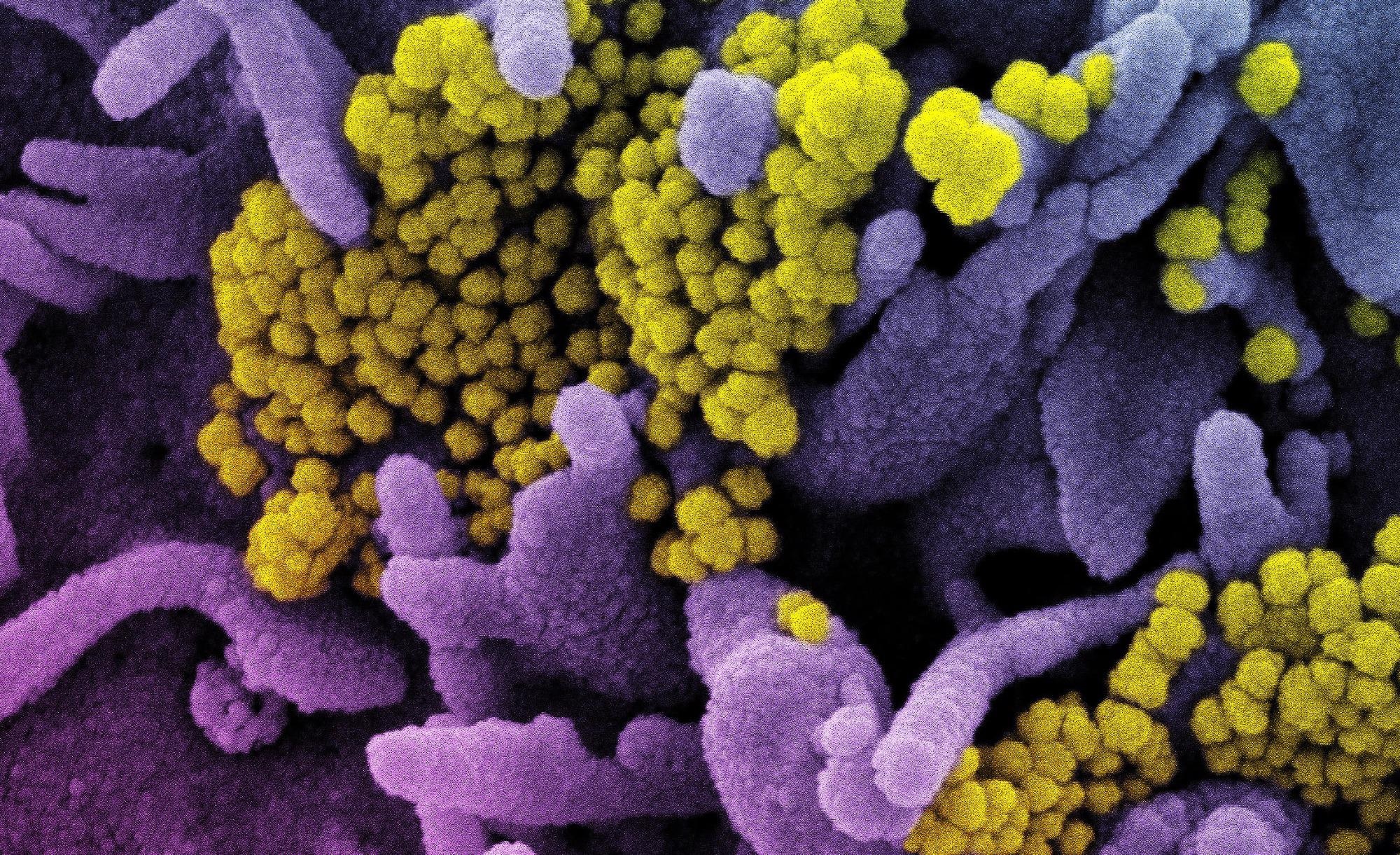 Study: Identification of FDA-approved Bifonazole as SARS-CoV-2 blocking agent following a bioreporter drug screen. Image Credit: NIAID