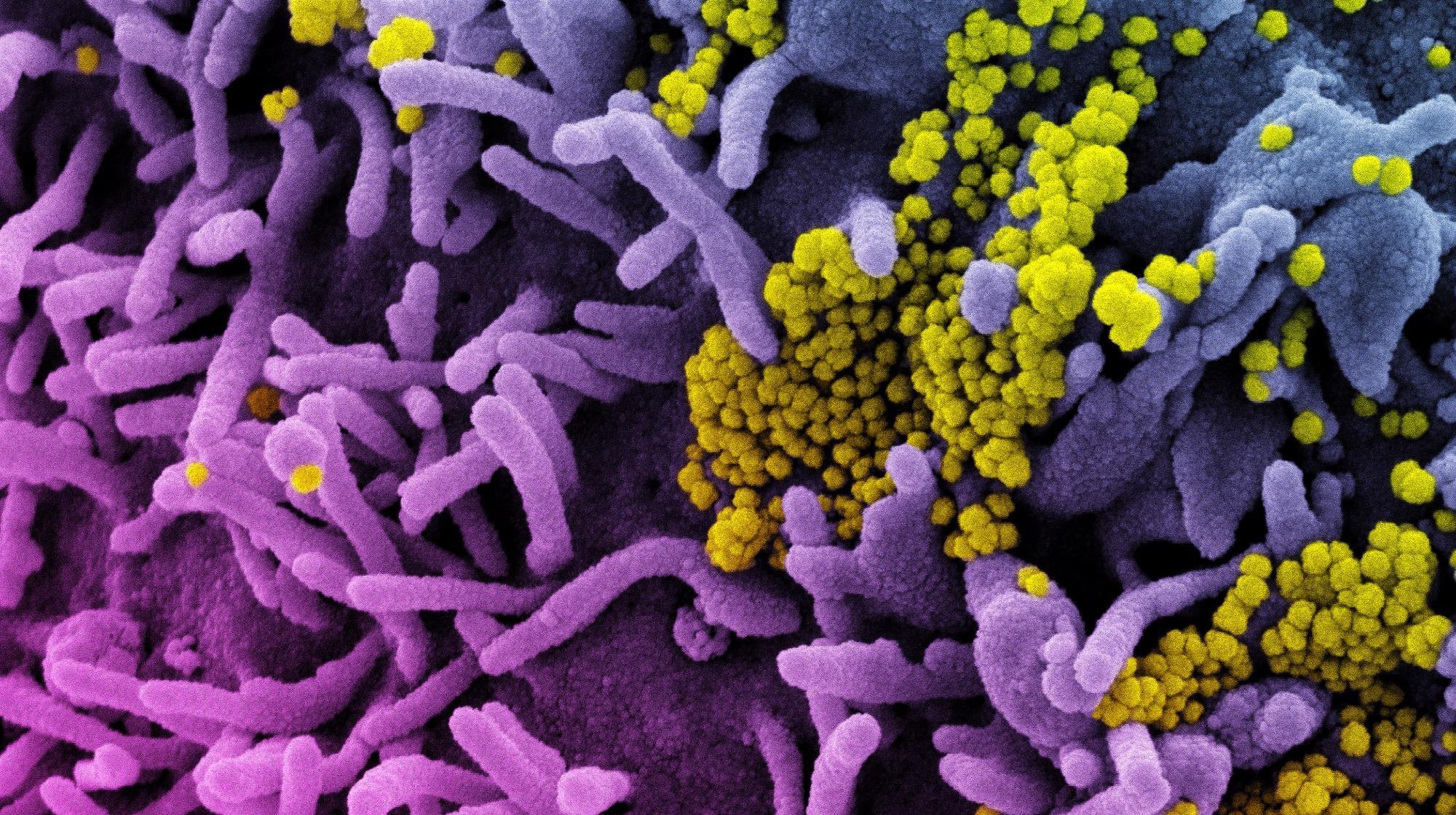 Study: An early warning system for emerging SARS-CoV-2 variants. Image Credit: NIAID