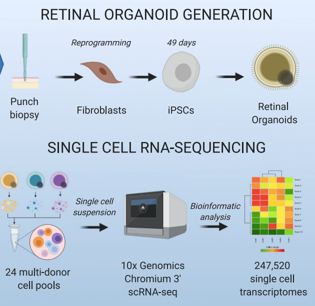 Stem cell models help determine previously unknown genetic markers of glaucoma