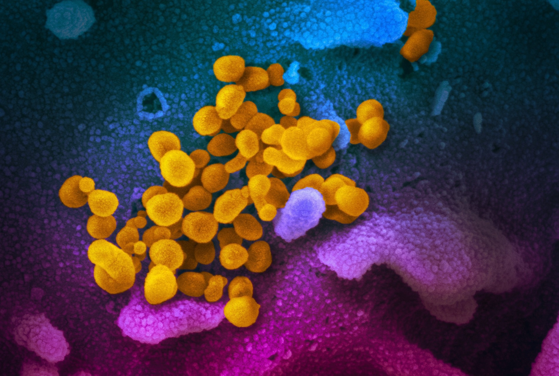 Study: Population immunity to pre-Omicron and Omicron SARS-CoV-2 variants in US states and counties through December 1, 2021. Image Credit: NIAID