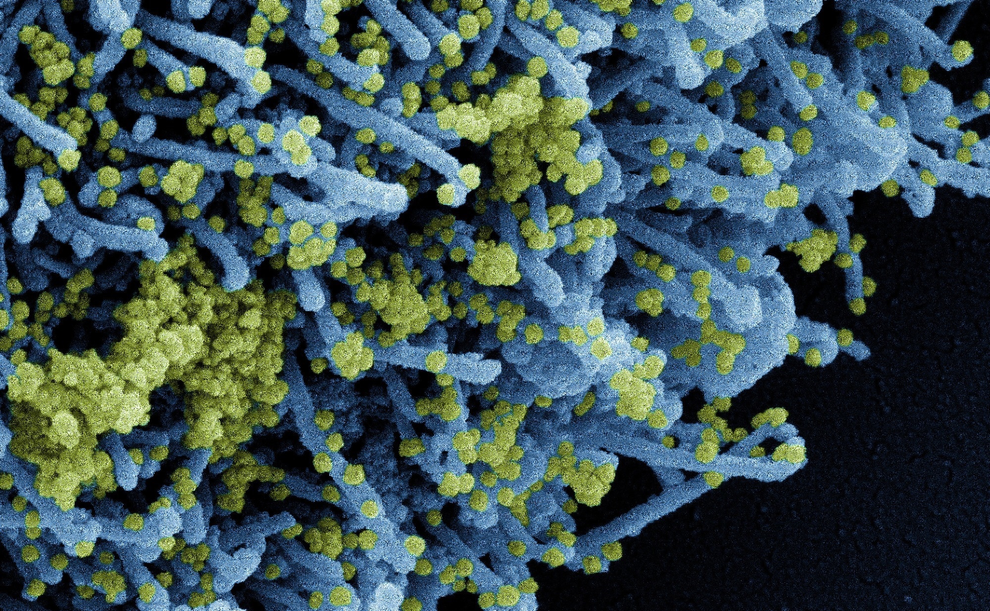 Study: Long distance airborne transmission of SARS-CoV-2: rapid systematic review. Image Credit: NIAID