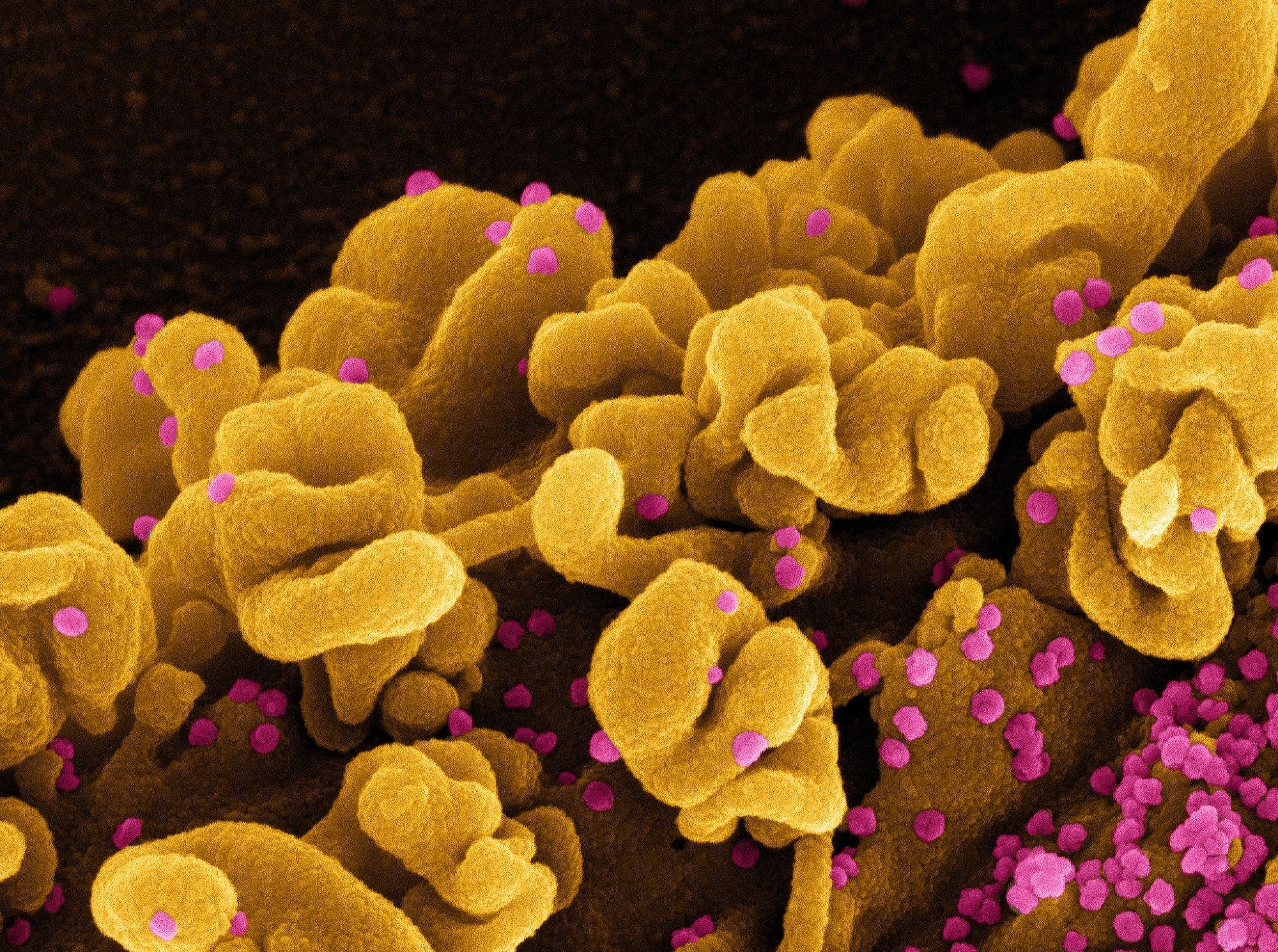 Study: Modelling airborne transmission of SARS-CoV-2 at a local scale. Image Credit: NIAID