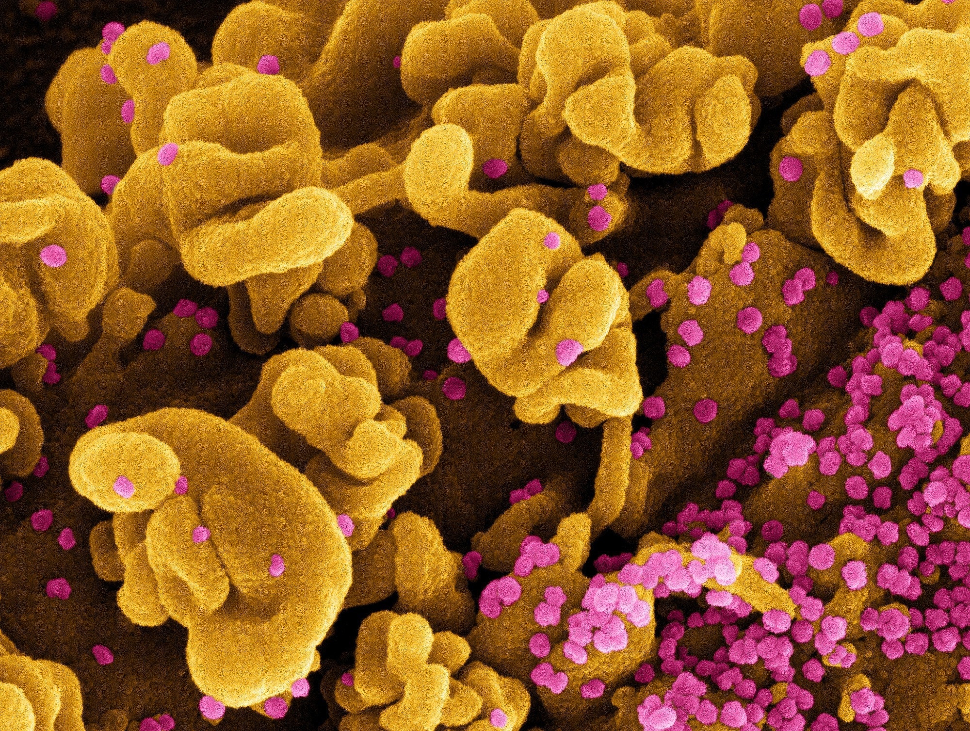 Study: Current trends in COVID-19 diagnosis and its new variants in physiological fluids: Surface antigens, antibodies, nucleic acids, and RNA sequencing. Image Credit: NIAID