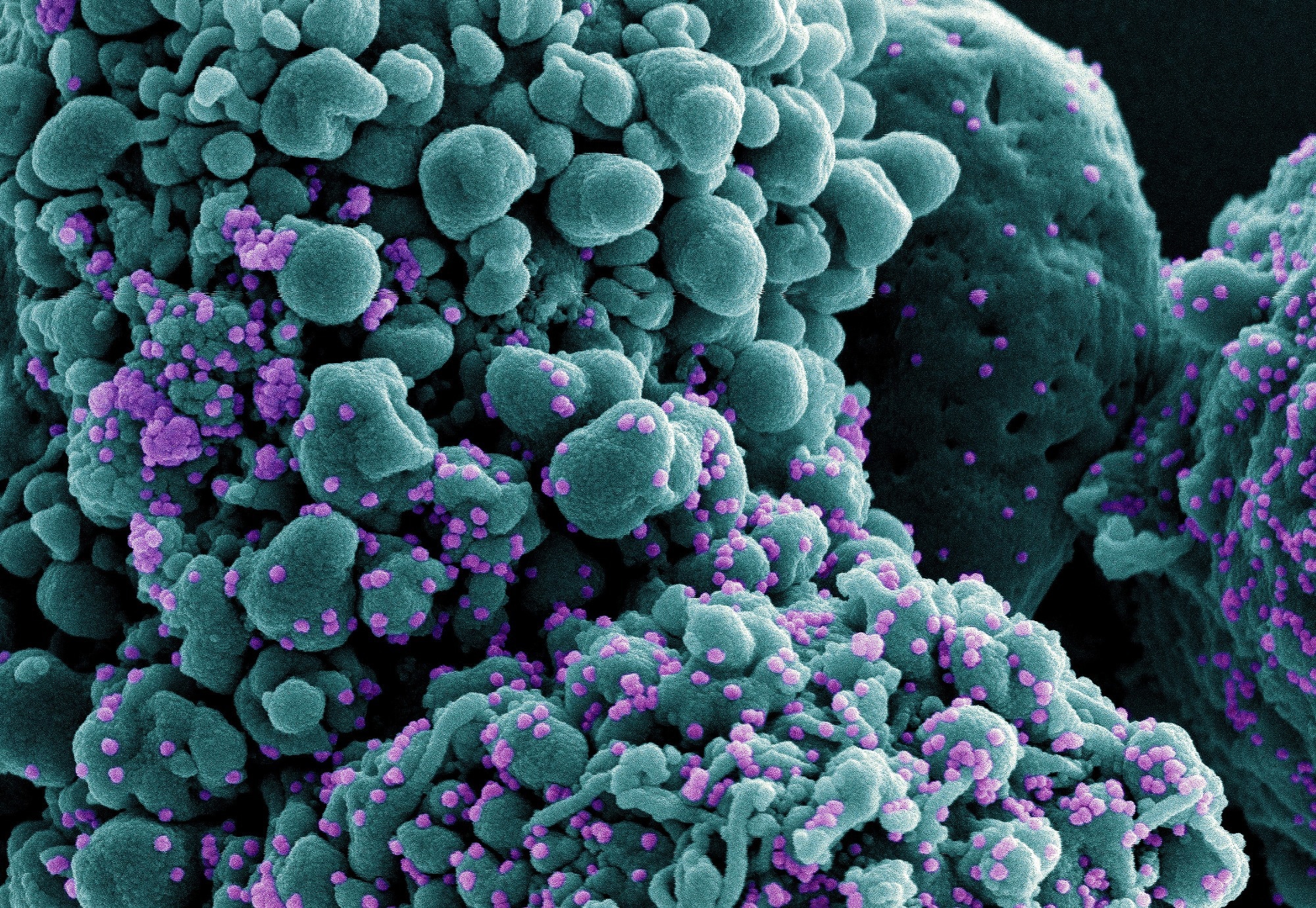 Study: An Antibody from Single Human VH-rearranging Mouse Neutralizes All SARS-CoV-2 Variants Through BA.5 by Inhibiting Membrane Fusion. Image Credit: NIAID