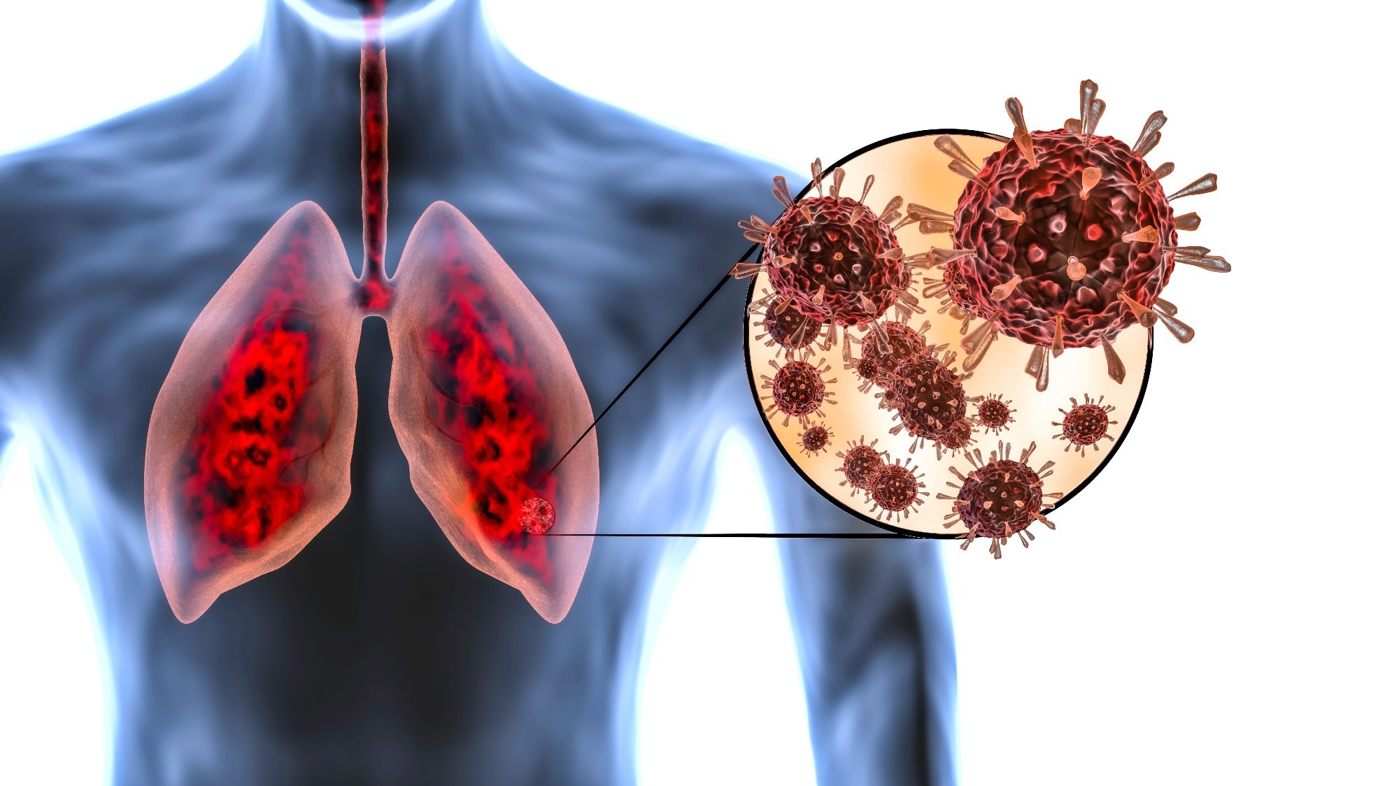 Study: Pulmonary Dysfunction after Pediatric COVID-19. Image Credit: MarcinWojc / Shutterstock
