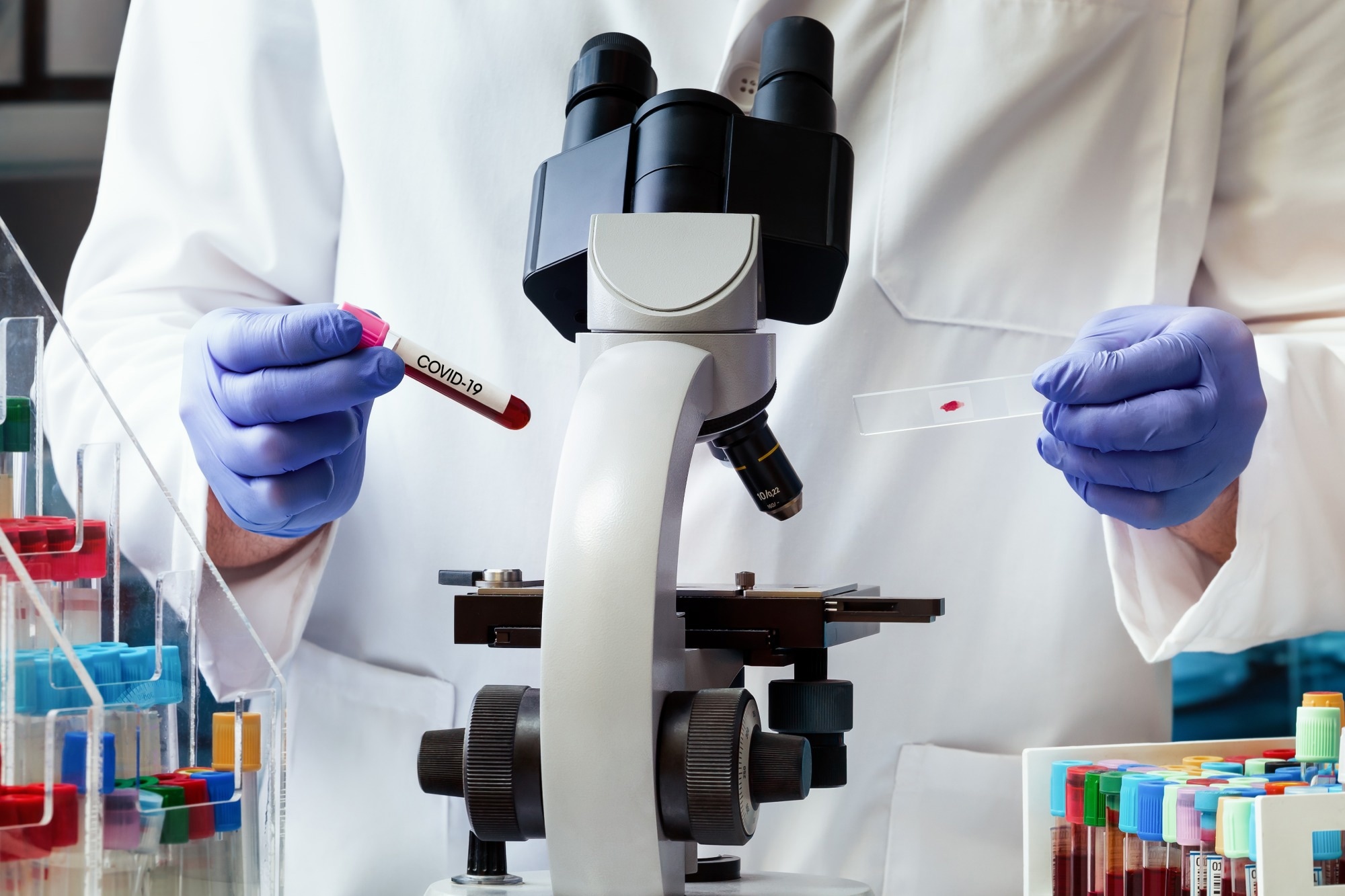 Study: Global SARS-CoV-2 seroprevalence from January 2020 to April 2022: A systematic review and meta-analysis of standardized population-based studies. Image Credit: angellodeco/Shutterstock