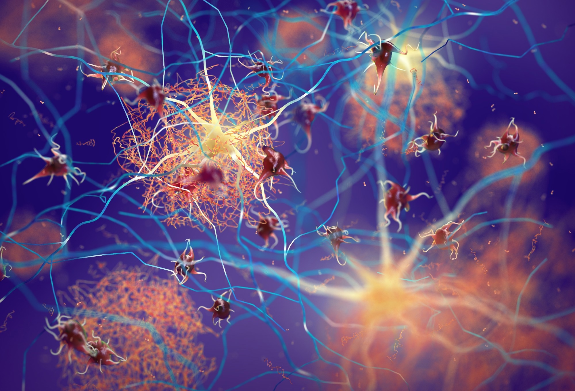 Study: The effects of time-restricted eating on sleep, cognitive decline, and Alzheimer