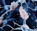 Klotho protein levels protect against cognitive decline in Alzheimer patients