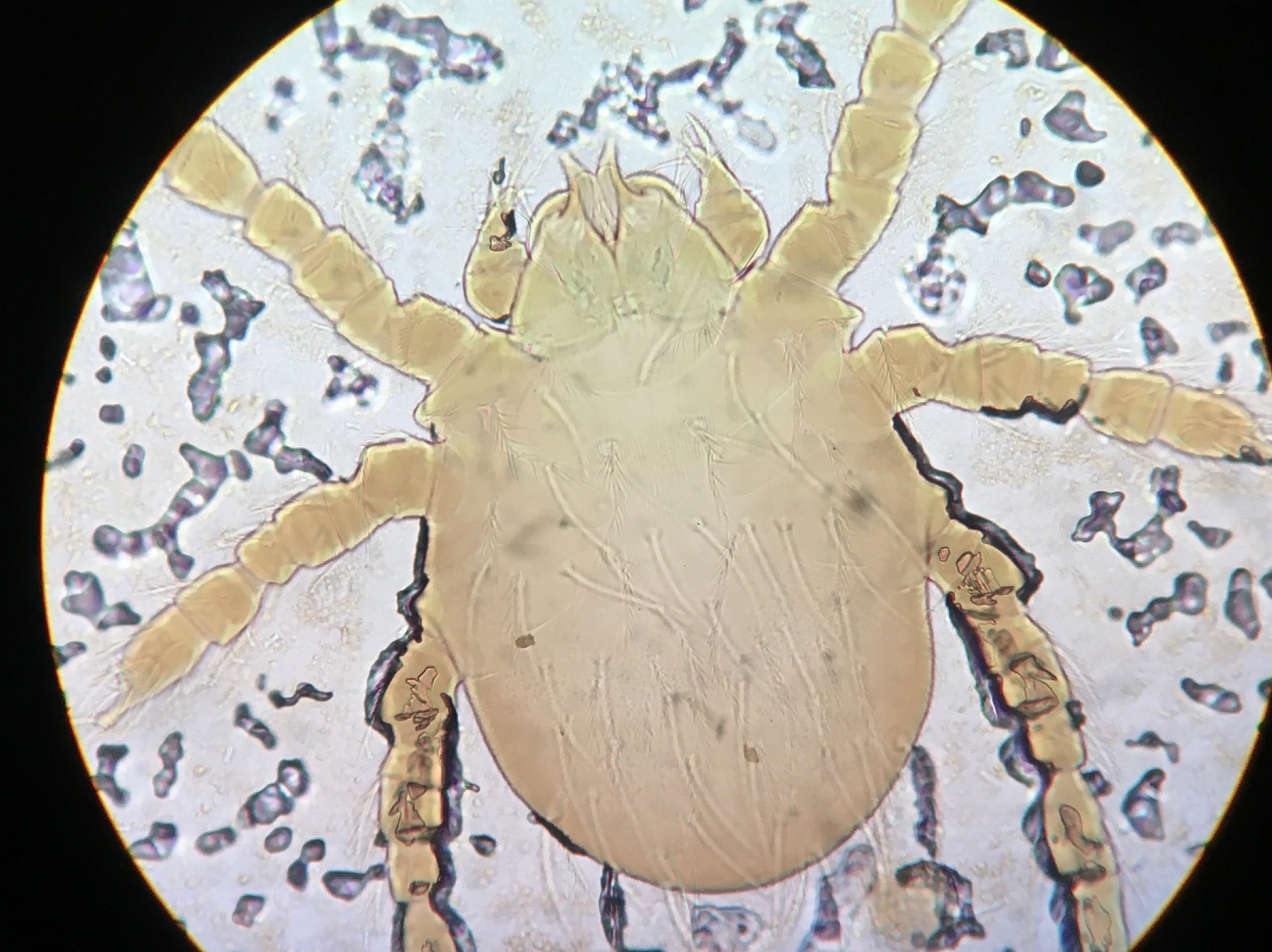 Study: Host transcriptomic profiling of CD-1 outbred mice with severe clinical outcomes following infection with Orientia tsutsugamushi Image Credit: Anestial / Shutterstock