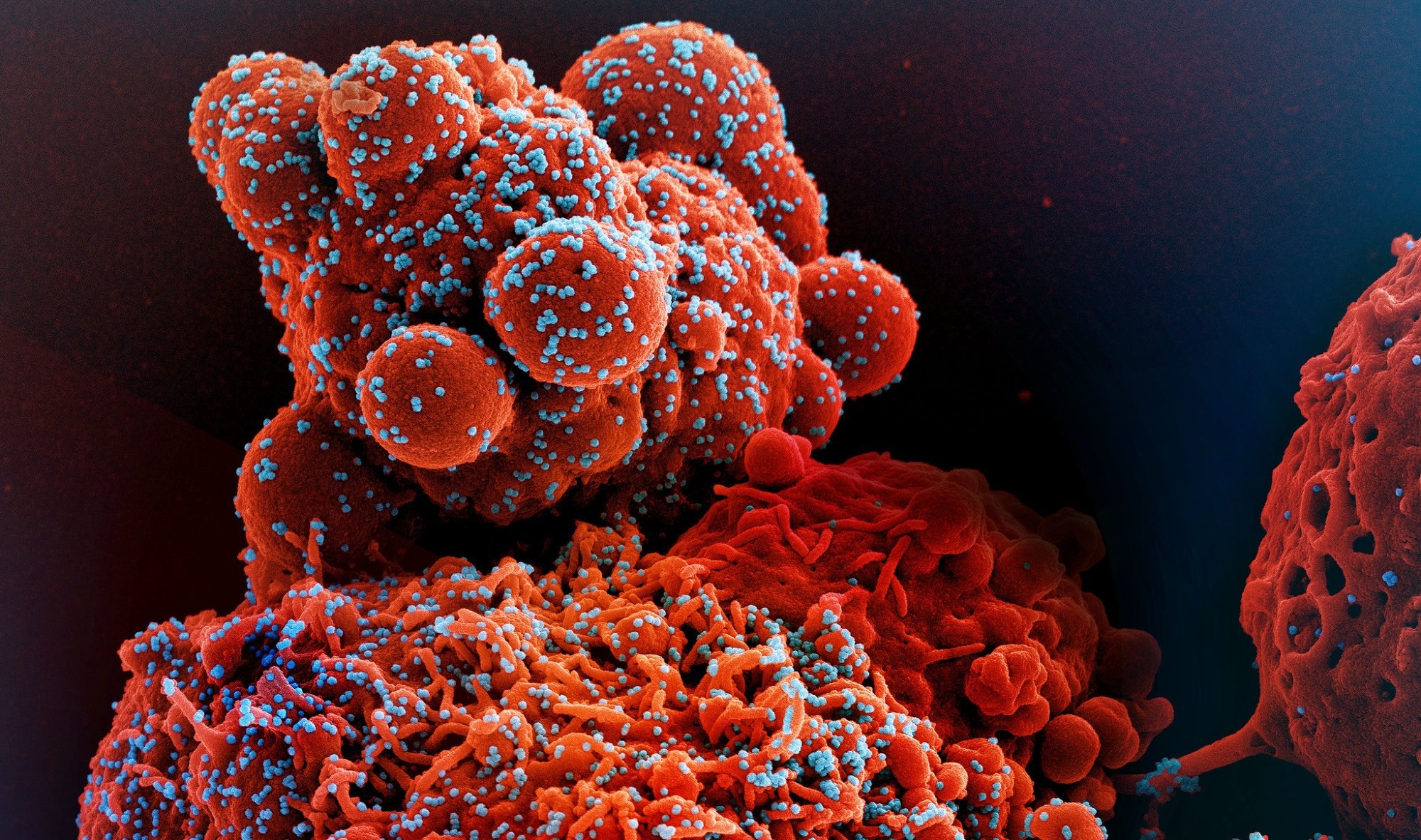 Study: Early Treatment with Pegylated Interferon Lambda for Covid-19. Image Credit: NIAID