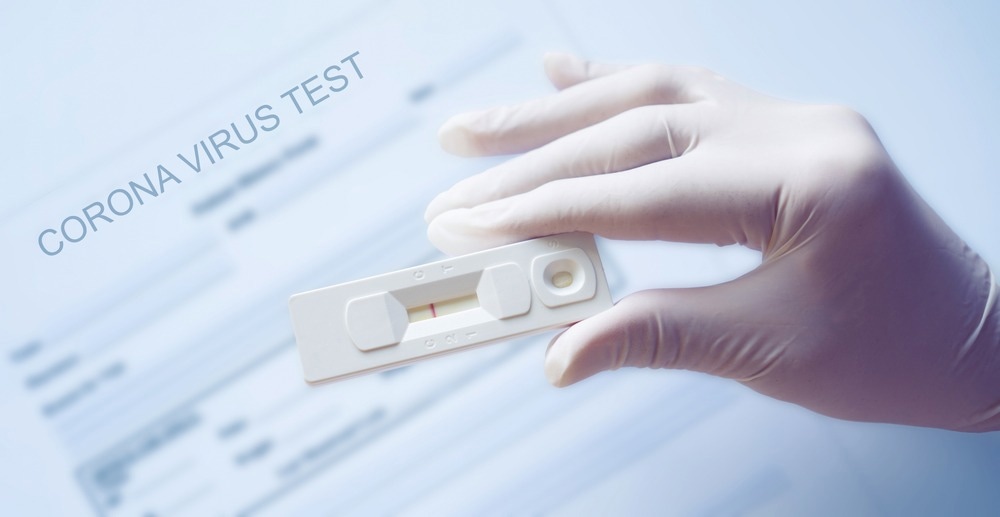 Study: Effect of Predeparture Testing on Postarrival SARS-CoV-2–Positive Test Results Among International Travelers — CDC Traveler-Based Genomic Surveillance Program, Four U.S. Airports, March–September 2022. Image Credit: CrispyPork/Shutterstock