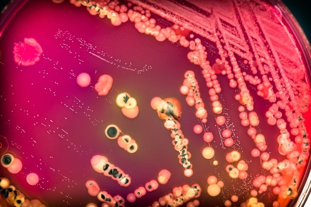 Study: The burden of CDI in the United States: a multifactorial challenge.  Image Credit: AnaLysiSStudiO / Shutterstock.com