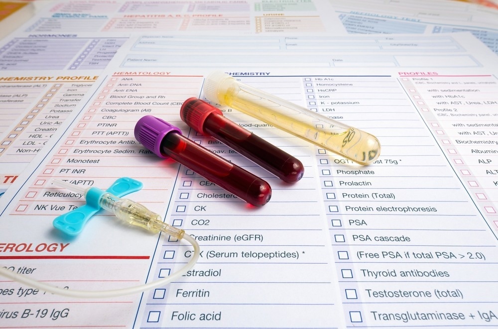 Study: Multiple early factors anticipate post-acute COVID-19 sequelae. Image Credit: angellodeco / Shutterstock.com