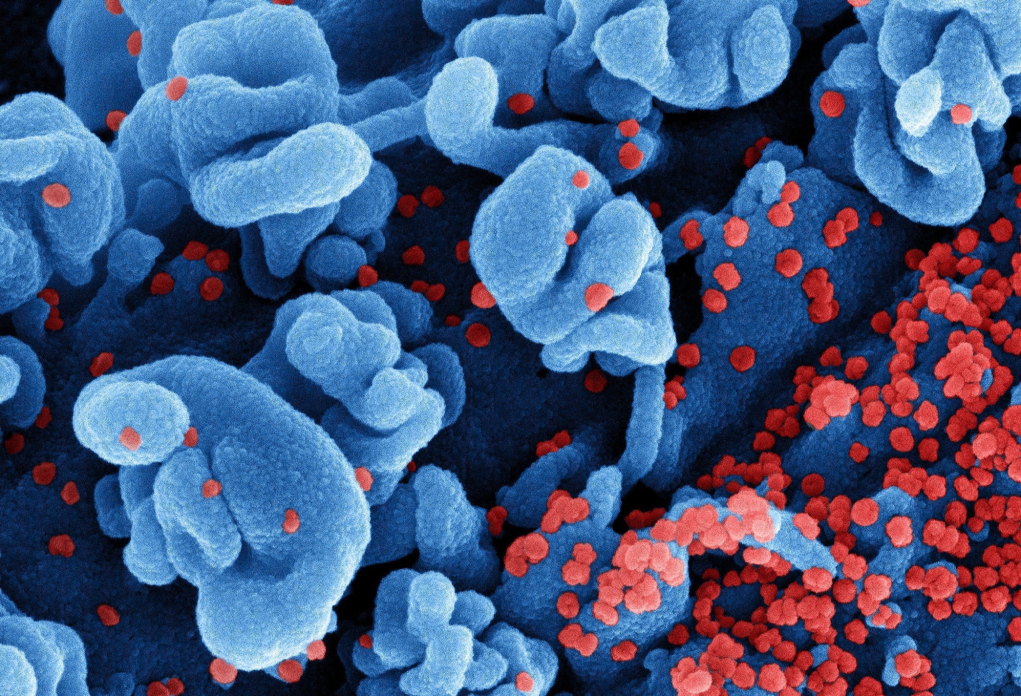 Study: Protection against symptomatic SARS-CoV-2 BA.5 infection conferred by the Pfizer-BioNTech Original/BA.4-5 bivalent vaccine compared to the mRNA Original (ancestral) monovalent vaccines – a matched cohort study in France. Image Credit: NIAID