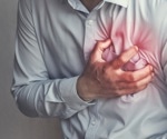 Study finds recent shingles infection increases the risk of myocardial infarction