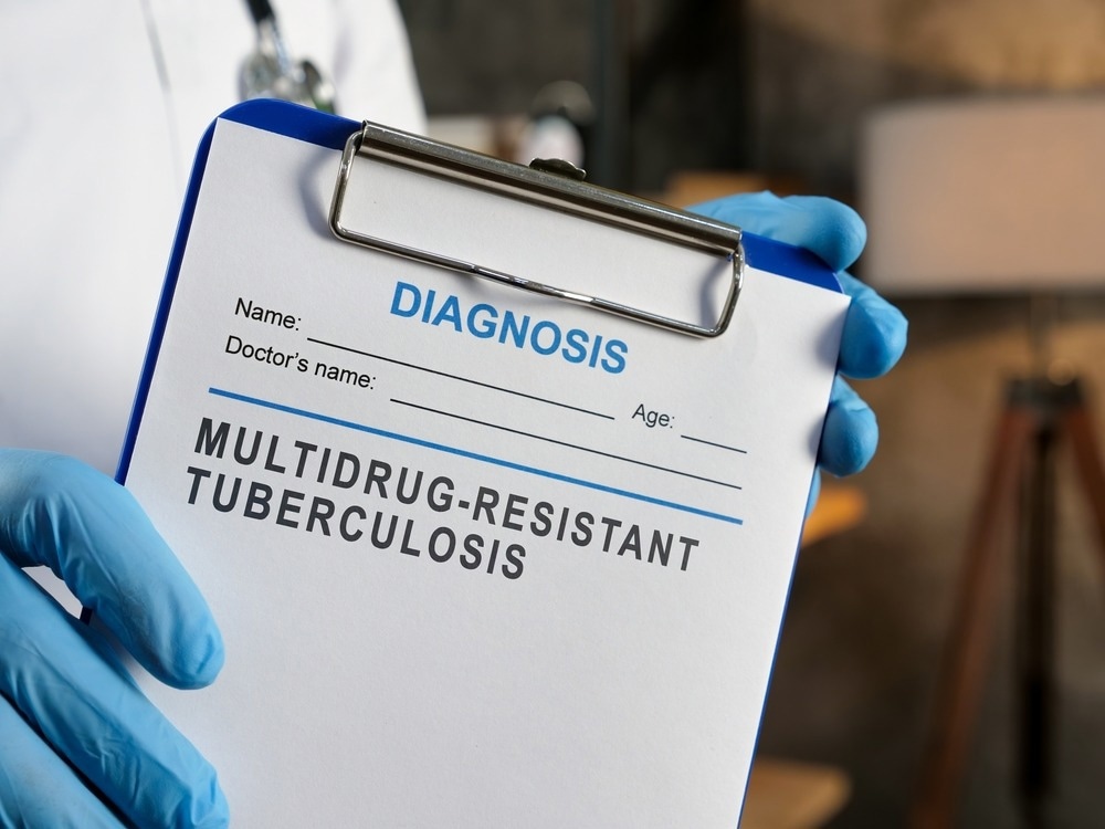 Study: At long last: short, all-oral regimens for multidrug-resistant tuberculosis in the United States. Image Credit: VitaliiVodolazskyi/Shutterstock.com