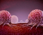 Copy number profiling provides insight as to why prostate cancer may become lethal