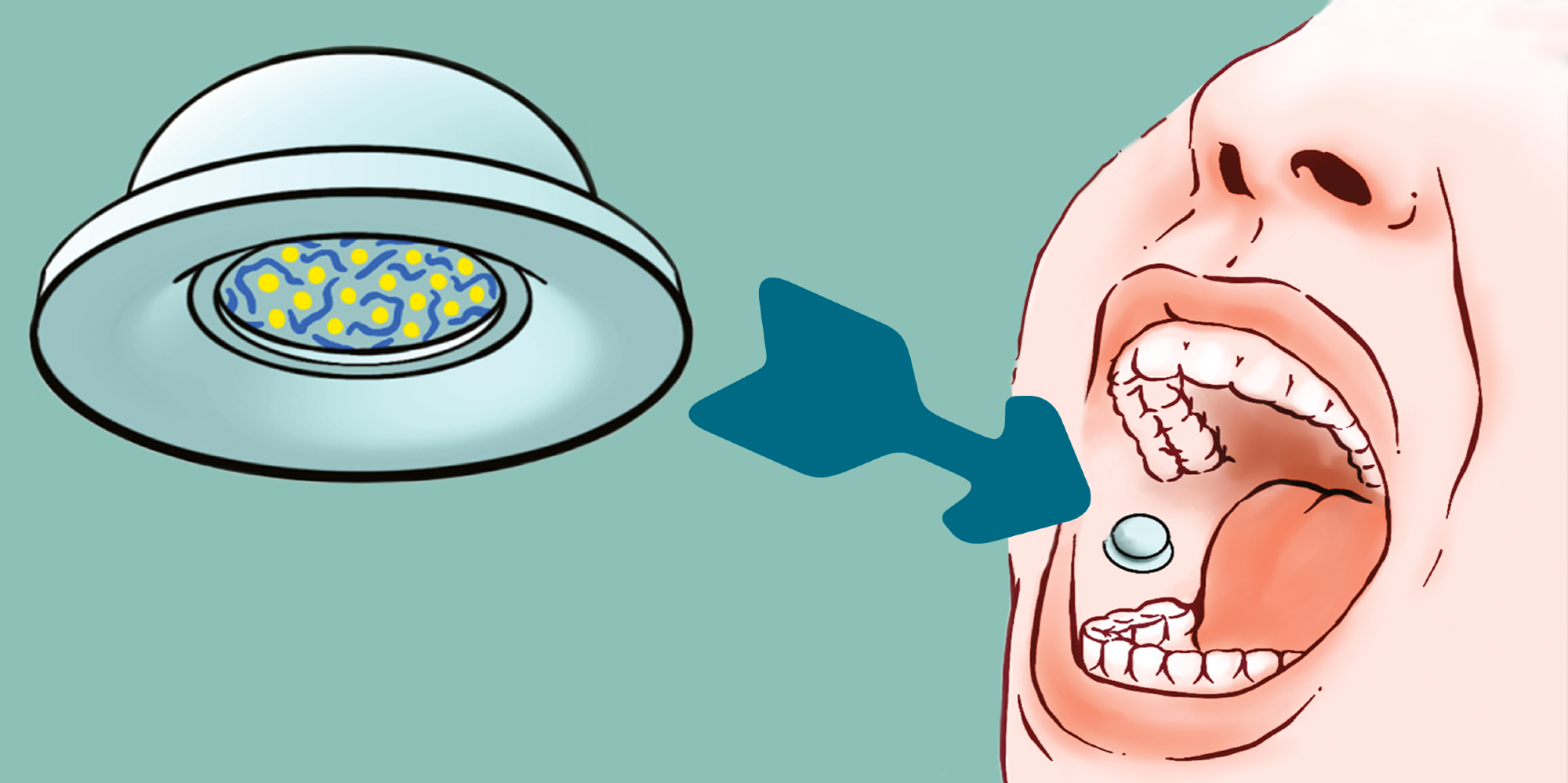 The suction cup contains active ingredients and can be pressed onto the lining of the check with two fingers. Image Credit: Luo Z et al. 2023