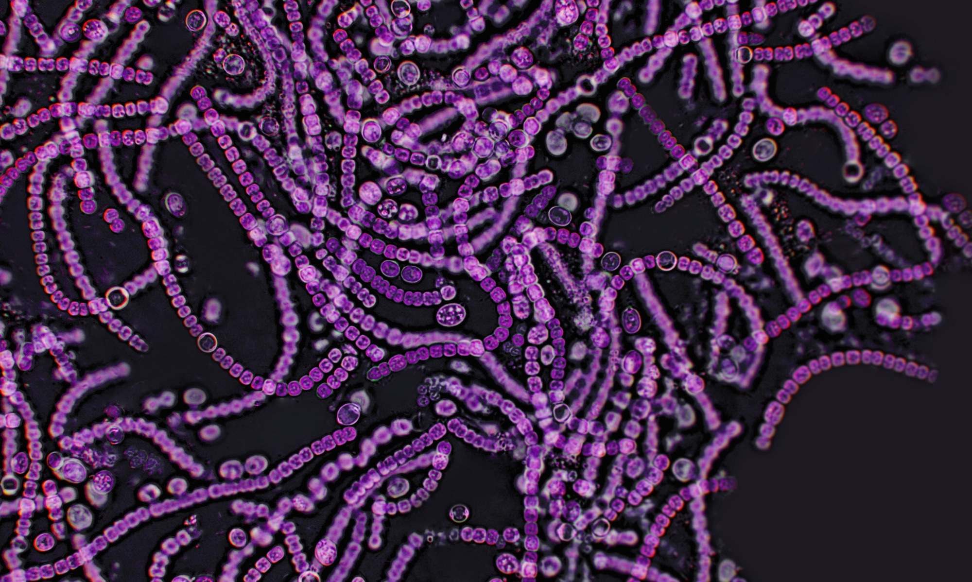 Study: Lactobacillus from the Altered Schaedler Flora maintain IFNγ homeostasis to promote behavioral stress resilience. Image Credit: Elif Bayraktar / Shutterstock