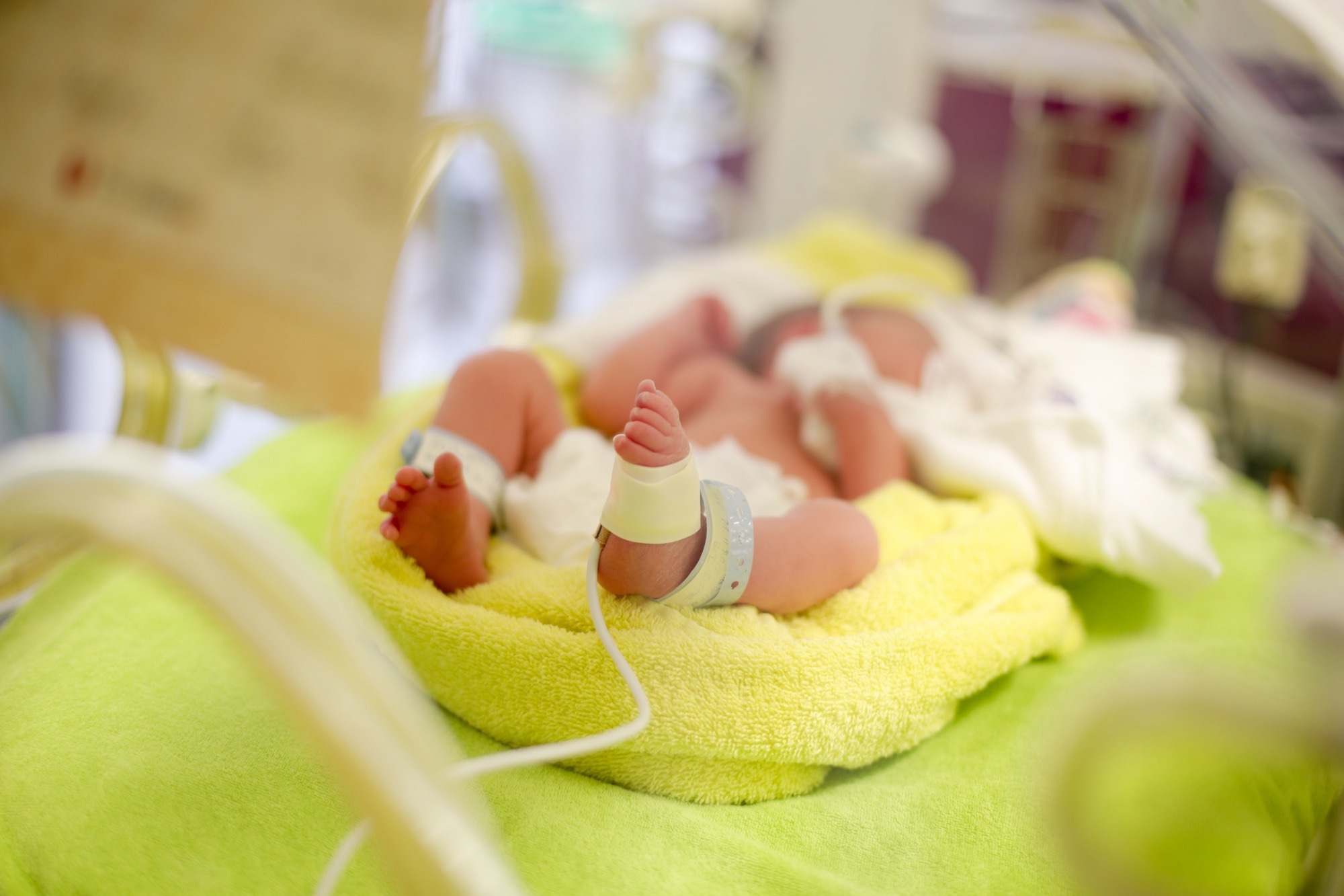 Study: Effect of human milk-based fortification in extremely preterm infants fed exclusively with breast milk: a randomised controlled trial. Image Credit: LullaBEE / Shutterstock