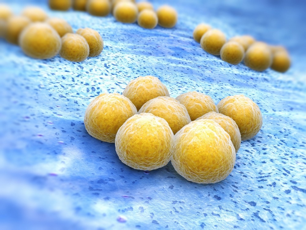Study: Bacterial pneumonia-induced shedding of epithelial heparan sulfate inhibits the bactericidal activity of cathelicidin in a murine model. Image Credit: Tatiana Shepeleva/Shutterstock.com