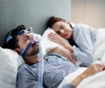 Sleep apnea in heart failure: Women face higher hospitalization risks