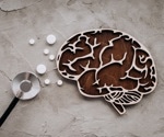 Dietary vitamin A shows promise in Alzheimer's disease intervention, study finds